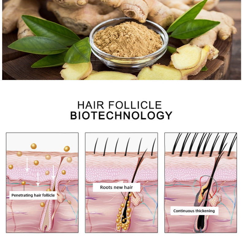 Hair Growth Oil Anti Hair Loss - Promotes Growth