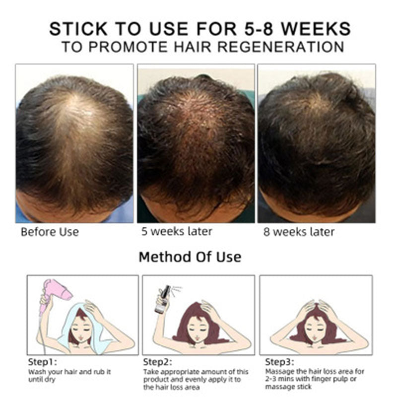 Hair Growth Oil Anti Hair Loss - Promotes Growth