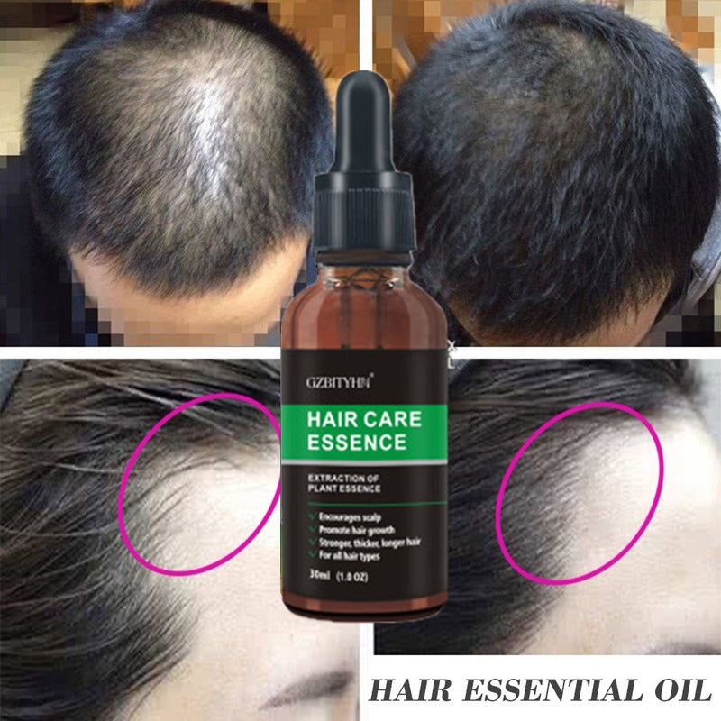 Hair Growth Oil Anti Hair Loss - Promotes Growth