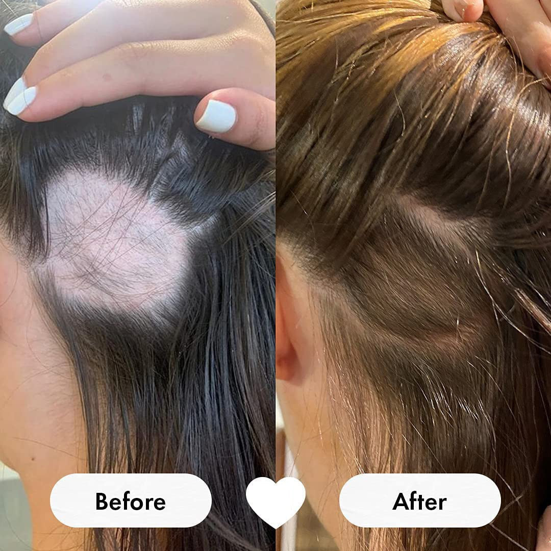 Biotin Hair Growth Gummies – 60 Count